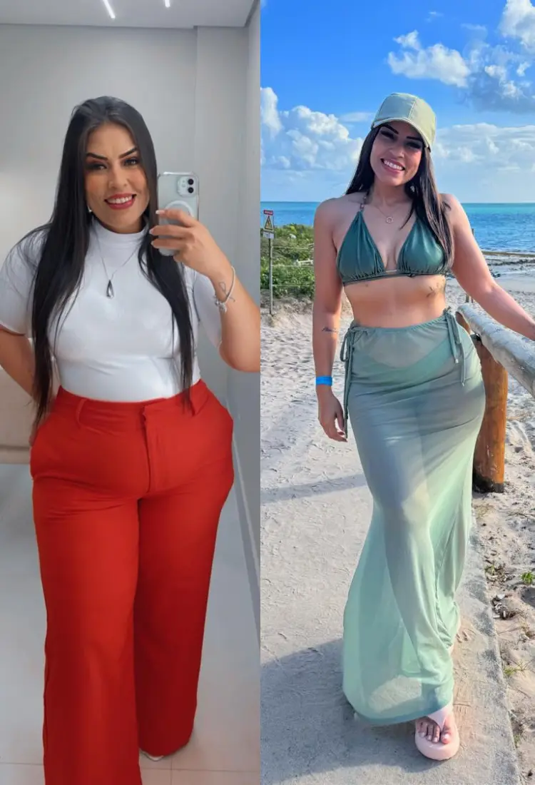 Antes e depois de Mariana Gualberto